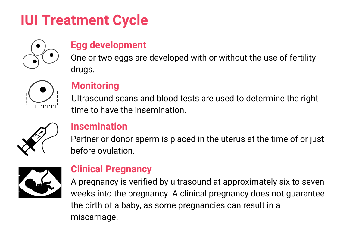 Fertility treatment explained